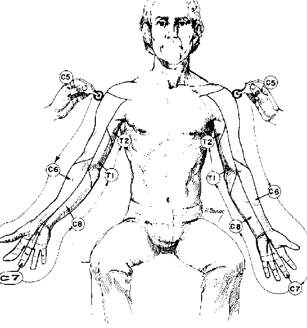 Upper Extremity Blocks